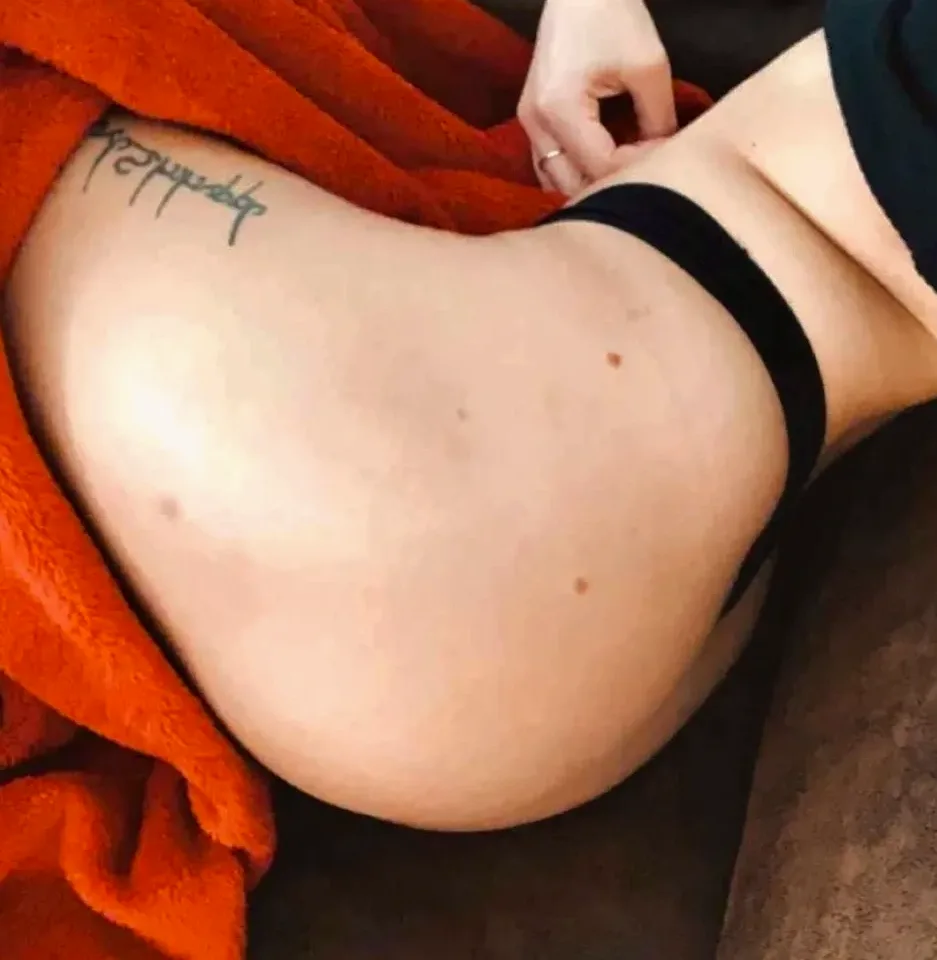 Adriana, 30 años